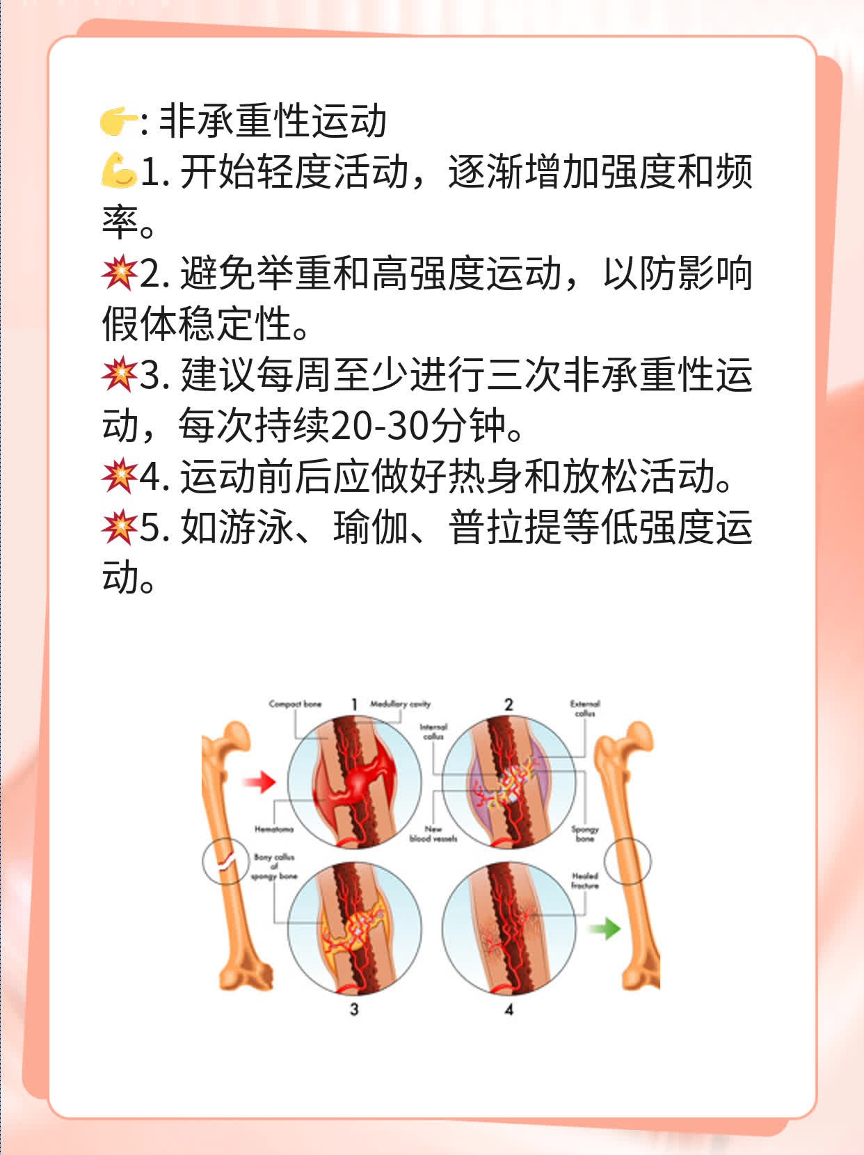 探讨乳腺癌假体稳定性：从手术到稳定的时长