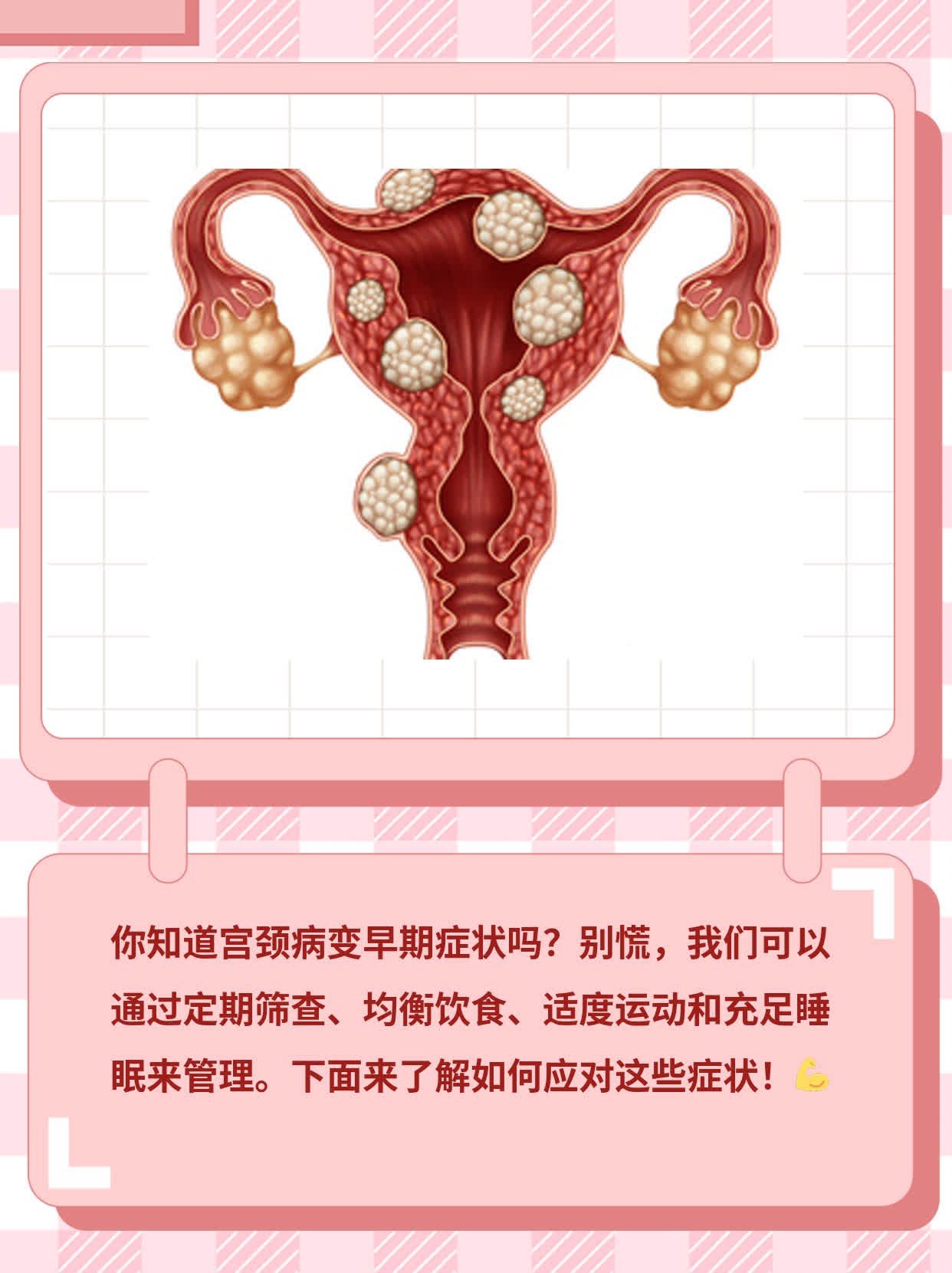 宫颈病变早期症状感受，你知道吗？