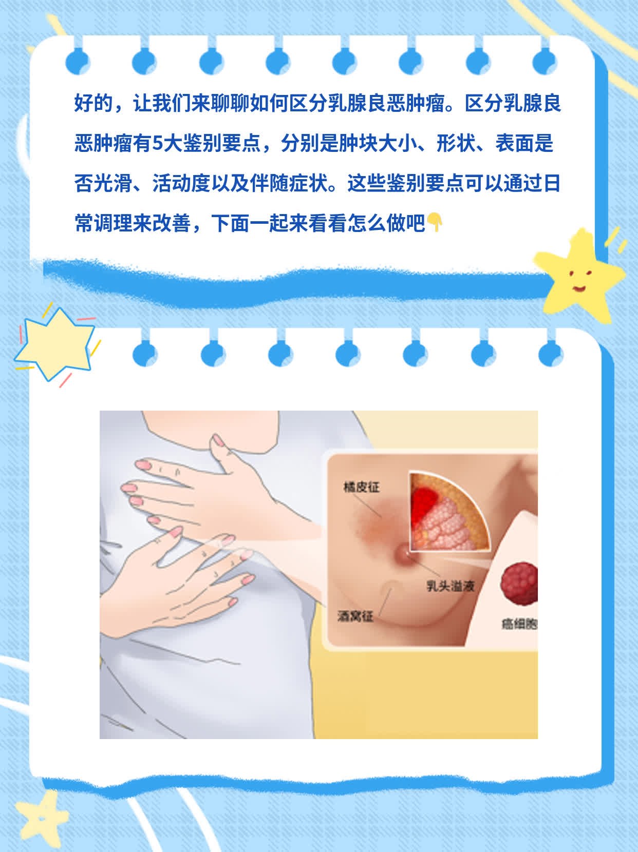 「分享经验」：如何区分乳腺良恶肿瘤？5大鉴别要点！