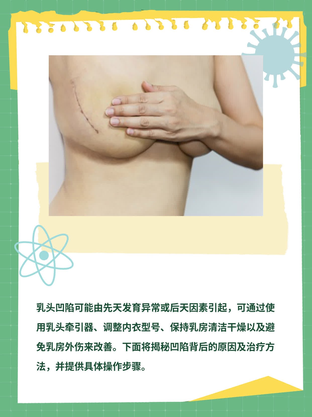 「乳头凹陷」：揭秘凹陷背后的原因及治疗方法！