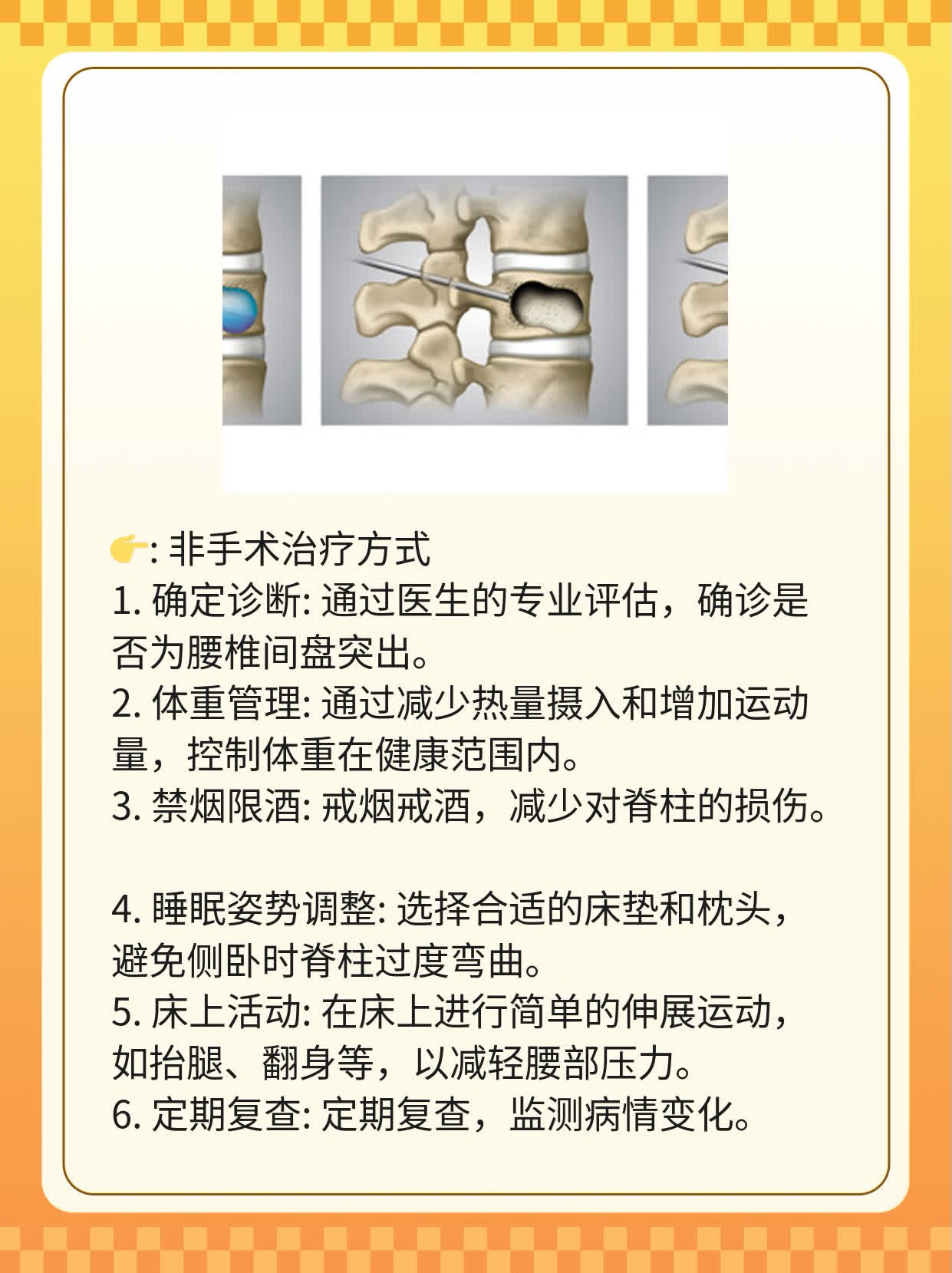 「分享」腰椎间盘突出康复训练秘笈！