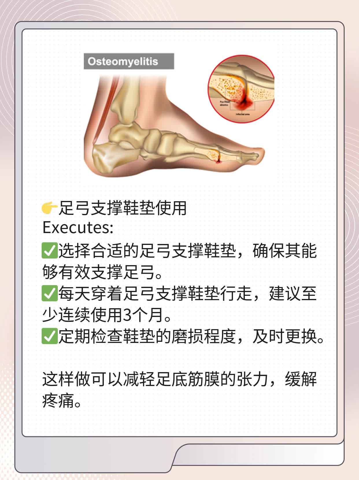 走路脚后跟痛？警惕足底筋膜炎！