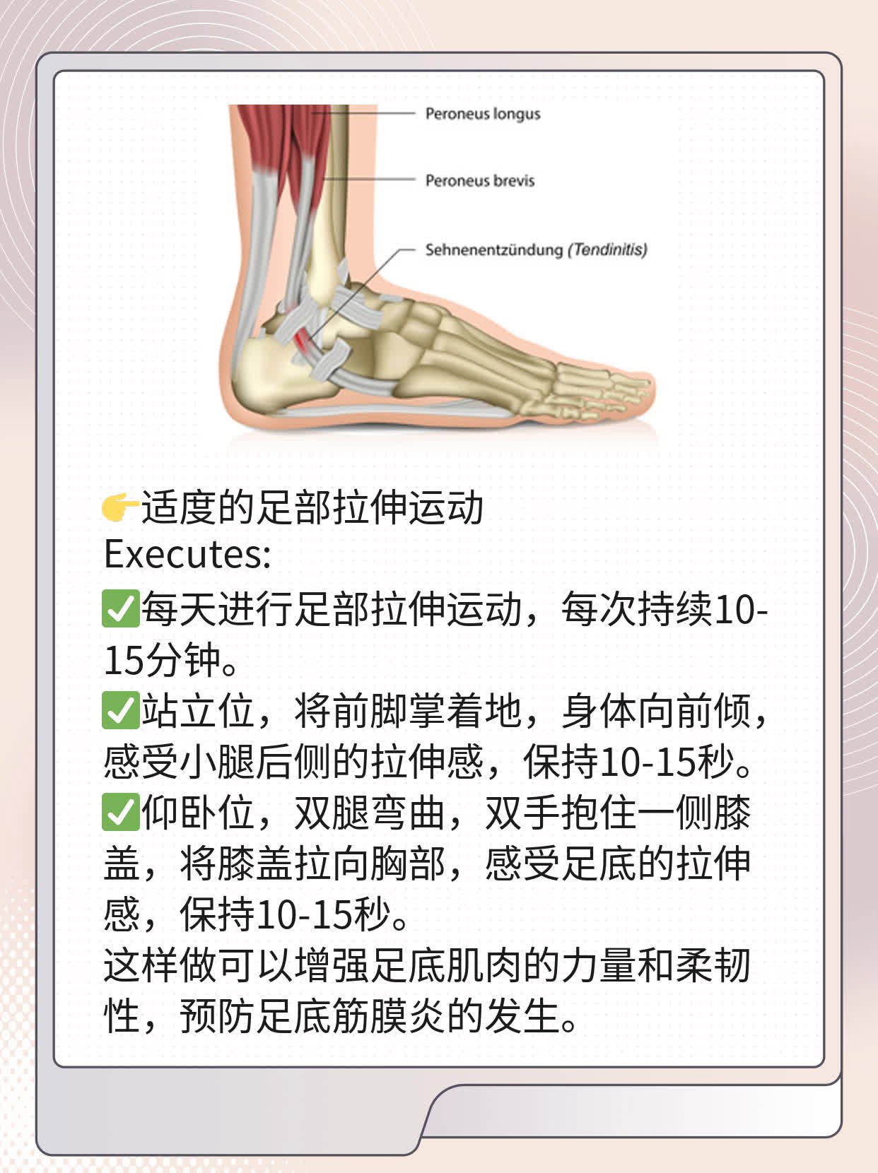 走路脚后跟痛？警惕足底筋膜炎！