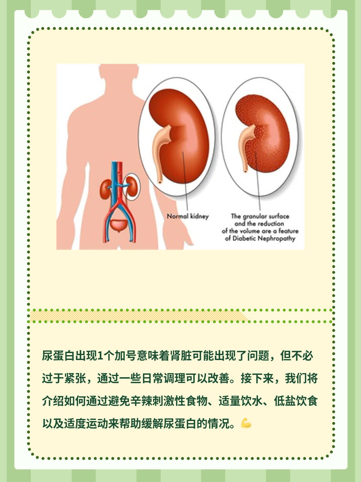 「尿蛋白+」初识：1个“+”号代表什么？