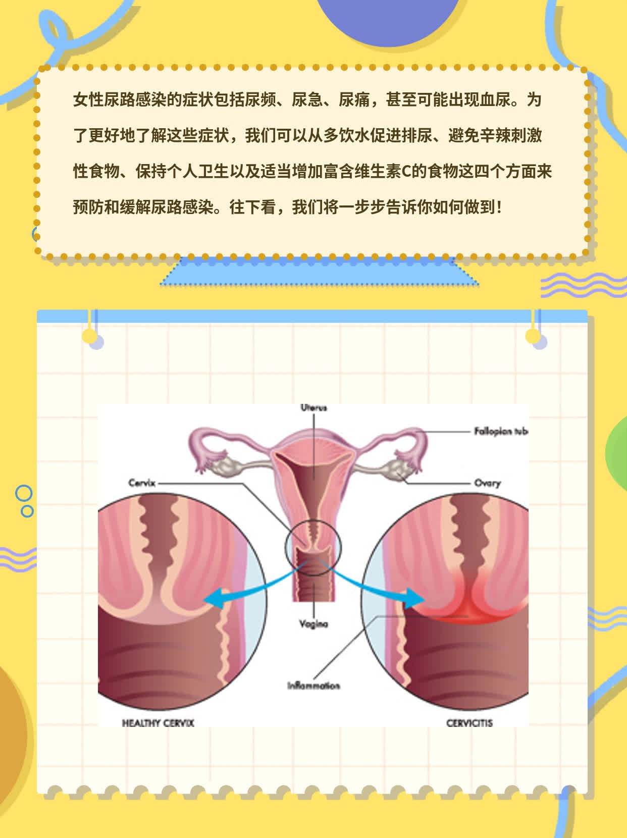 「有图有真相」女性尿路感染症状大盘点！