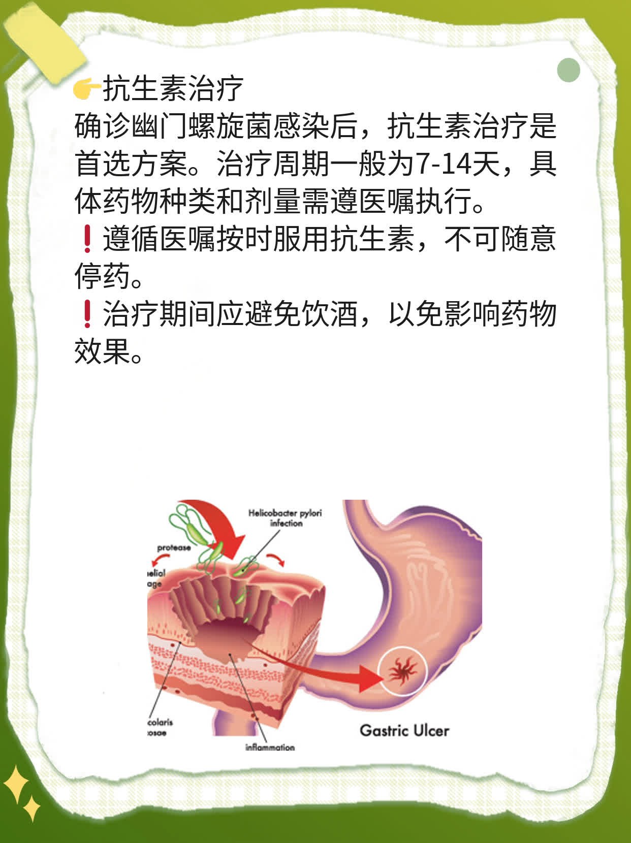 你知道吗？揭秘幽门螺旋菌感染自我诊断法！
