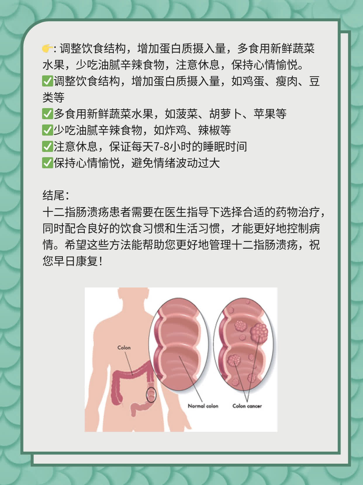 十二指肠溃疡用药攻略：选择适合你的良方！