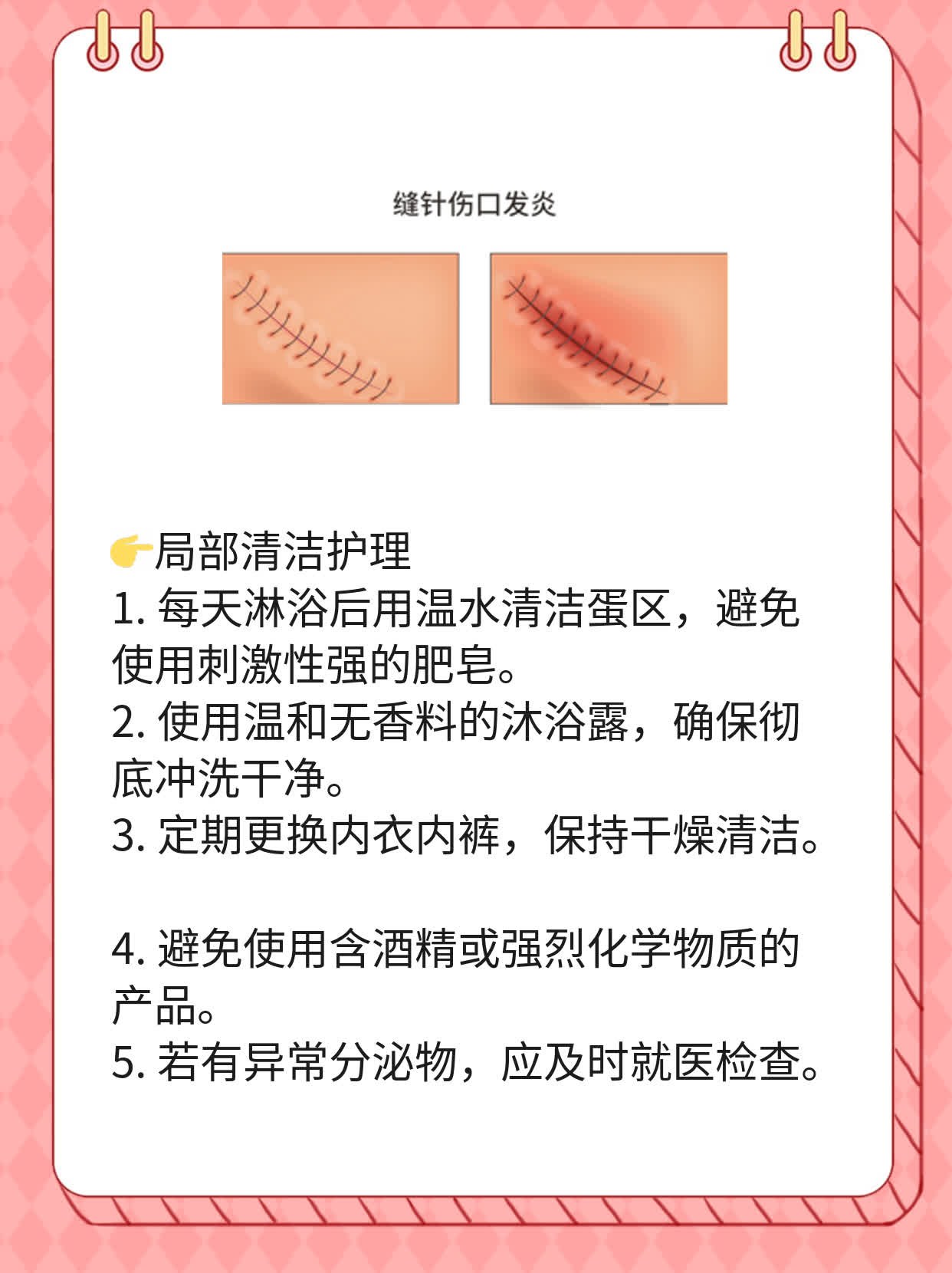 男人蛋皮瘙痒原因探秘：揪出隐藏的罪魁祸首！