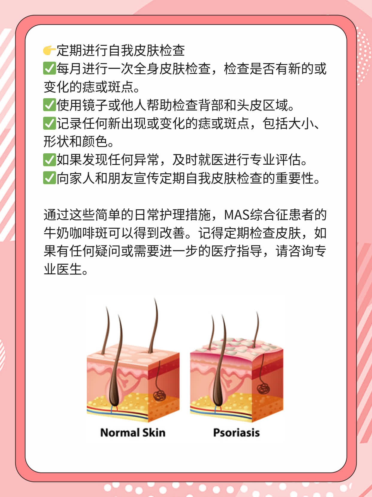 「揭秘」MAS综合征的牛奶咖啡斑图片大公开！