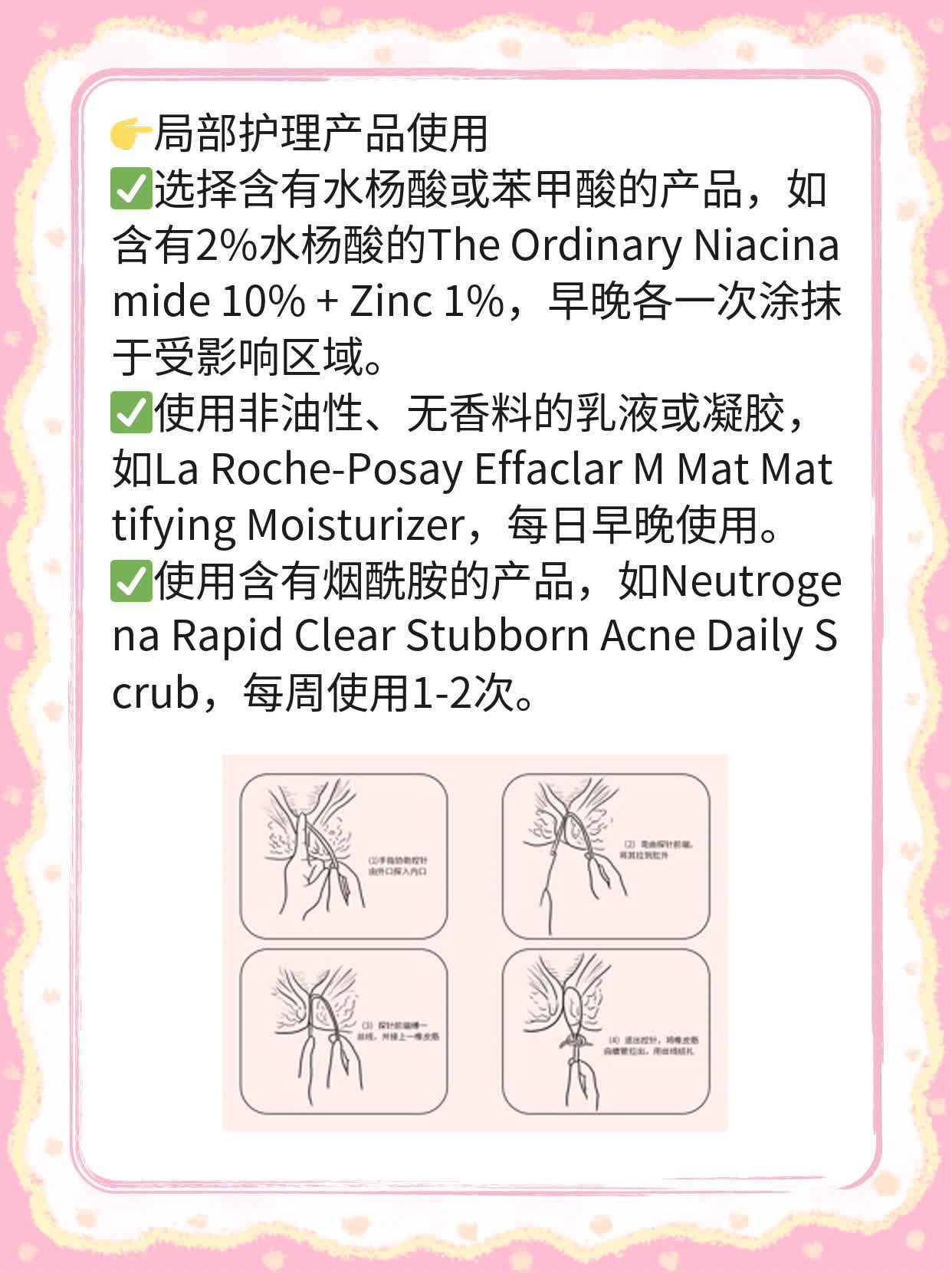 额上密密小痘？祛痘妙招来搞定！