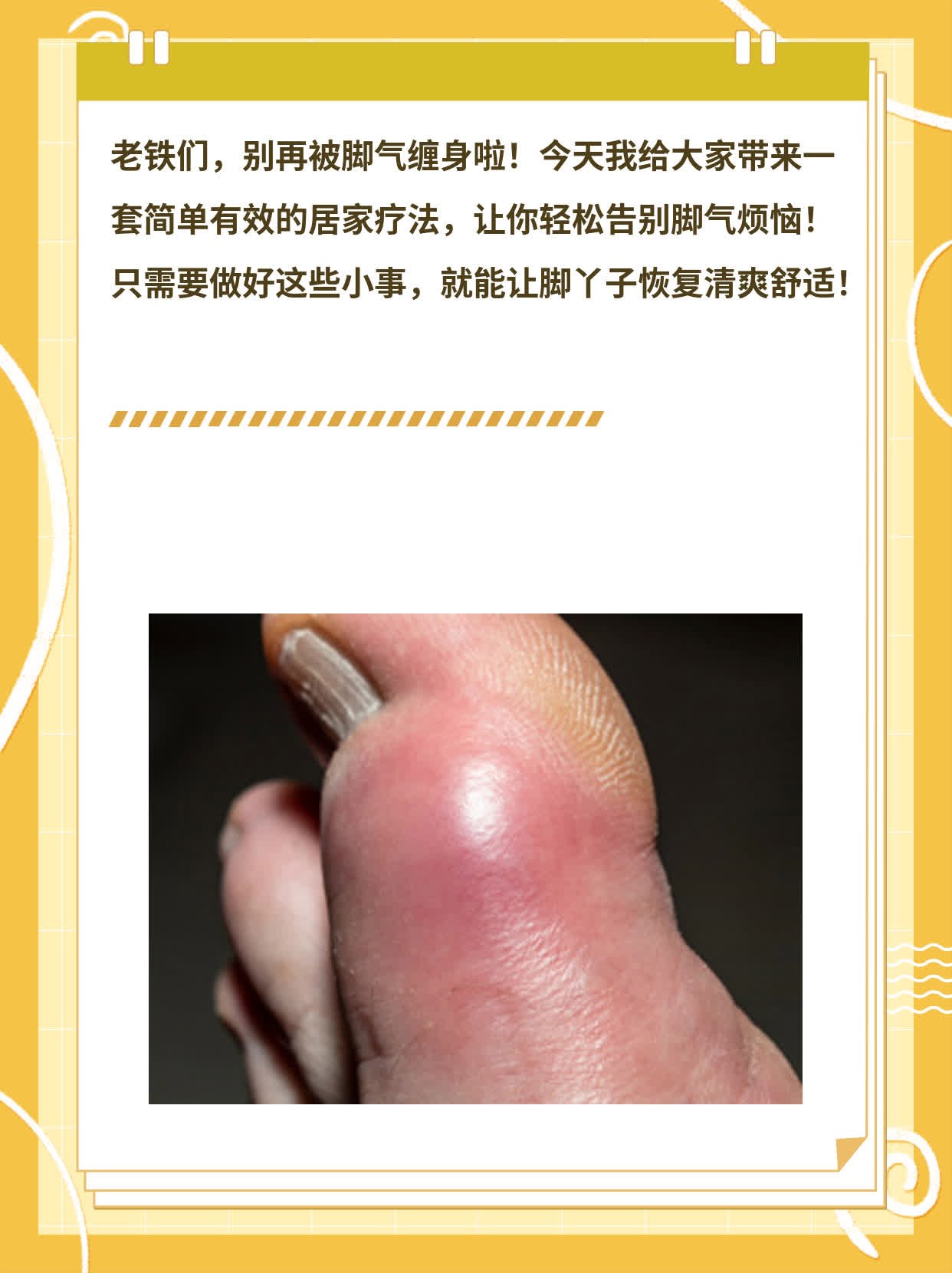 「根治脚气」：简单有效的居家疗法
