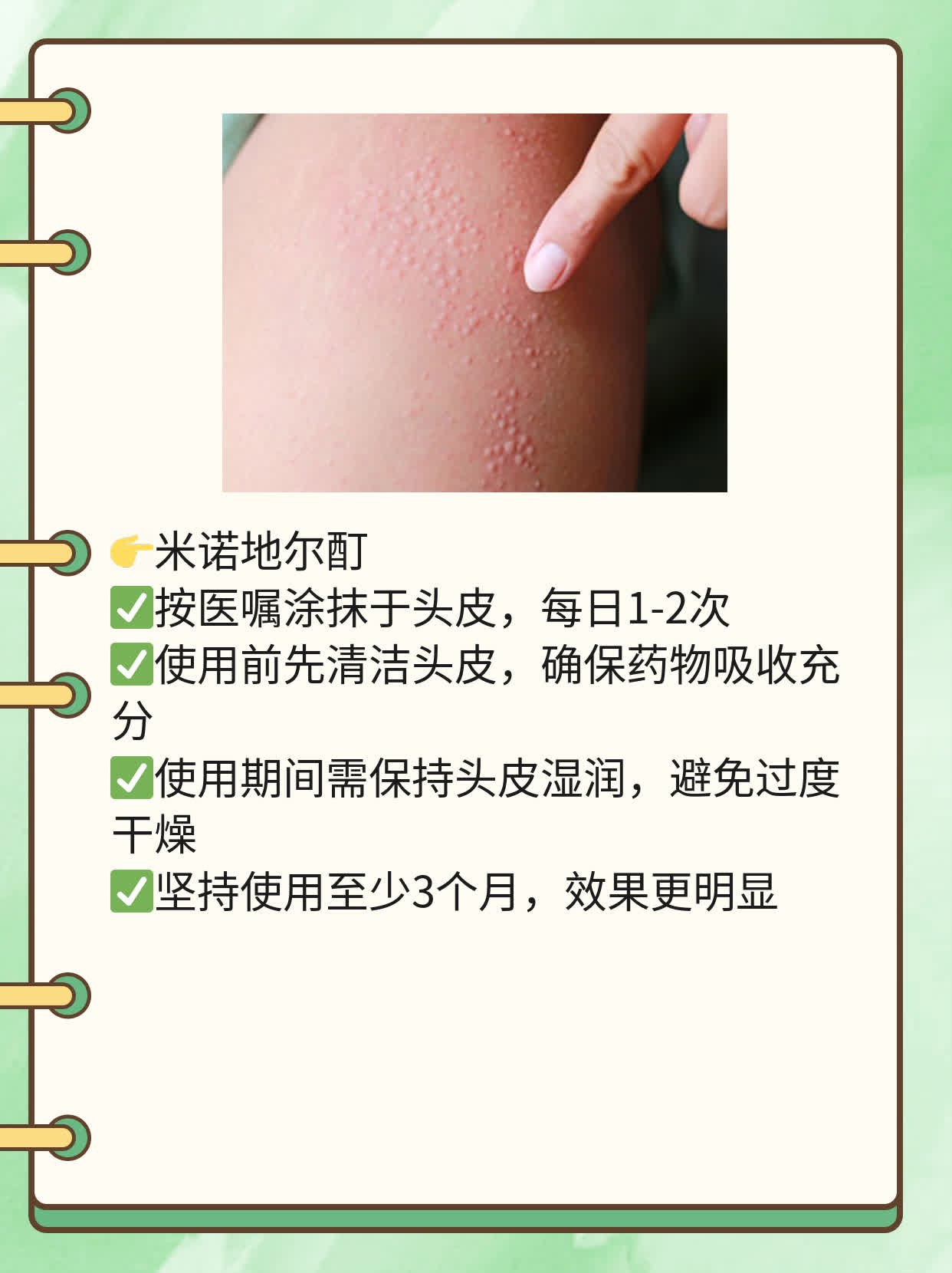 「掉发困扰」：年轻人脱发原因大揭秘！
