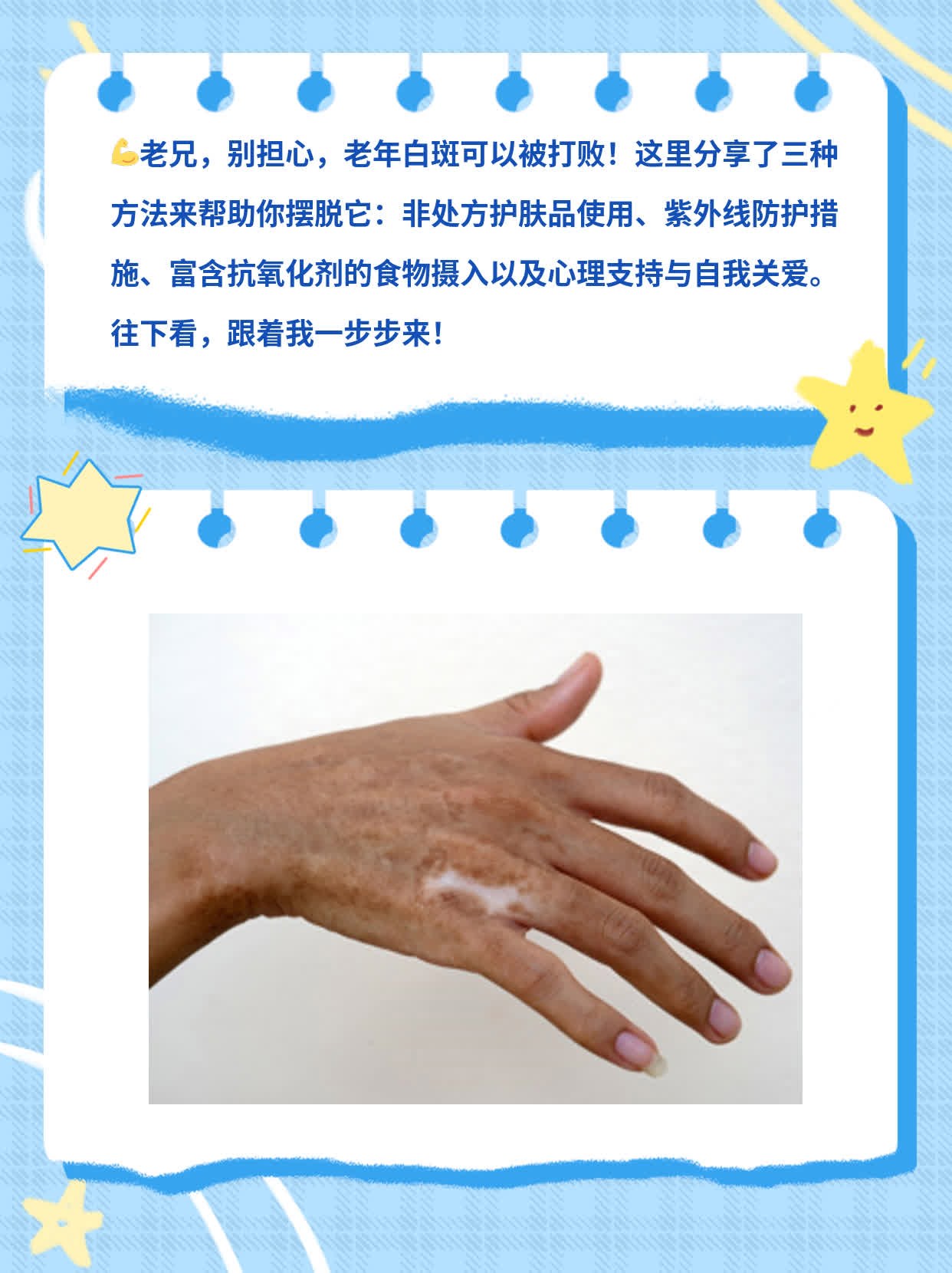 「摆脱老年白斑」的经验分享