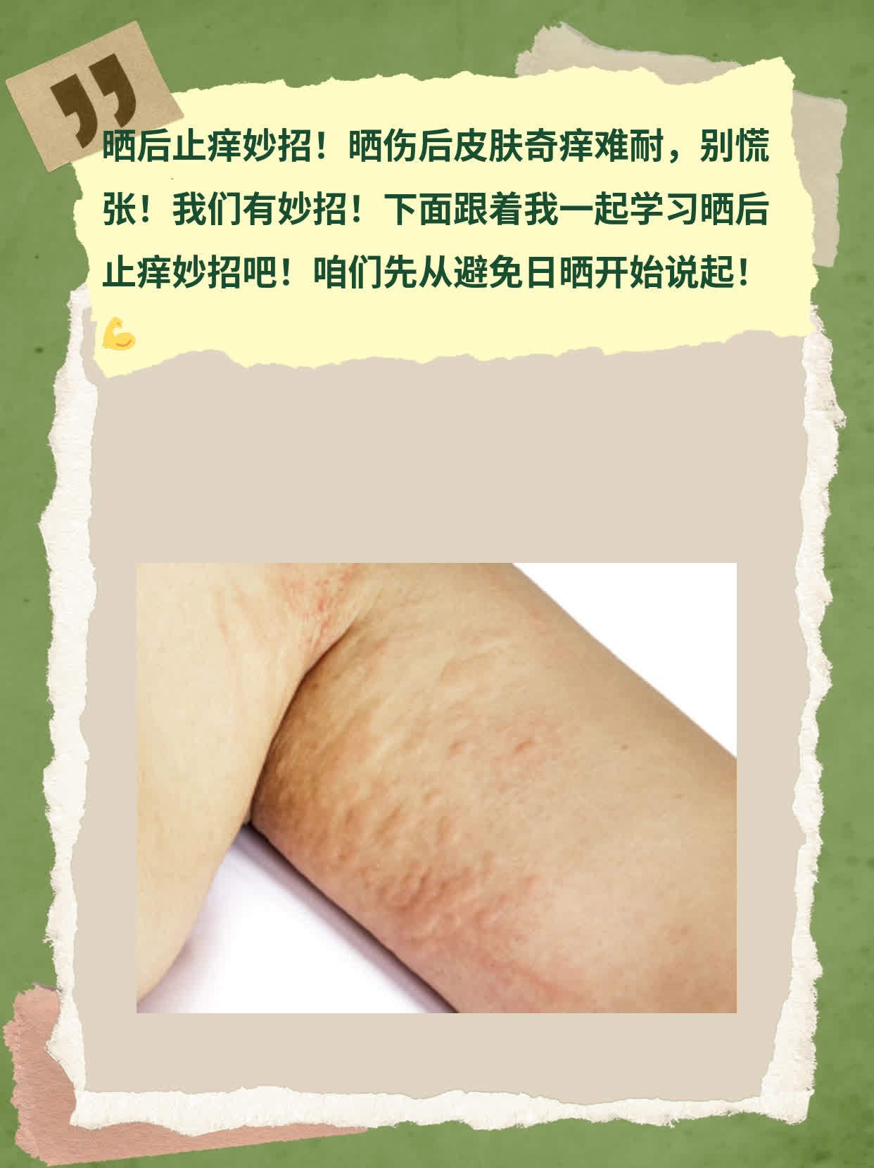 晒后止痒妙招！晒伤后皮肤奇痒难耐