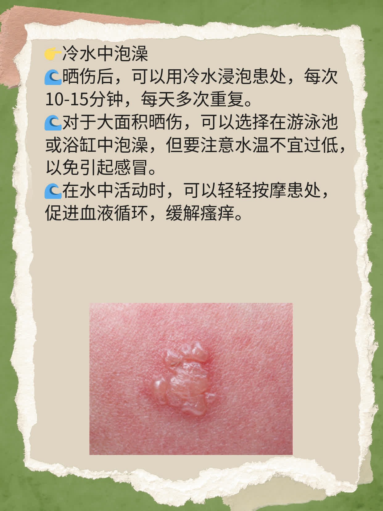 晒后止痒妙招！晒伤后皮肤奇痒难耐