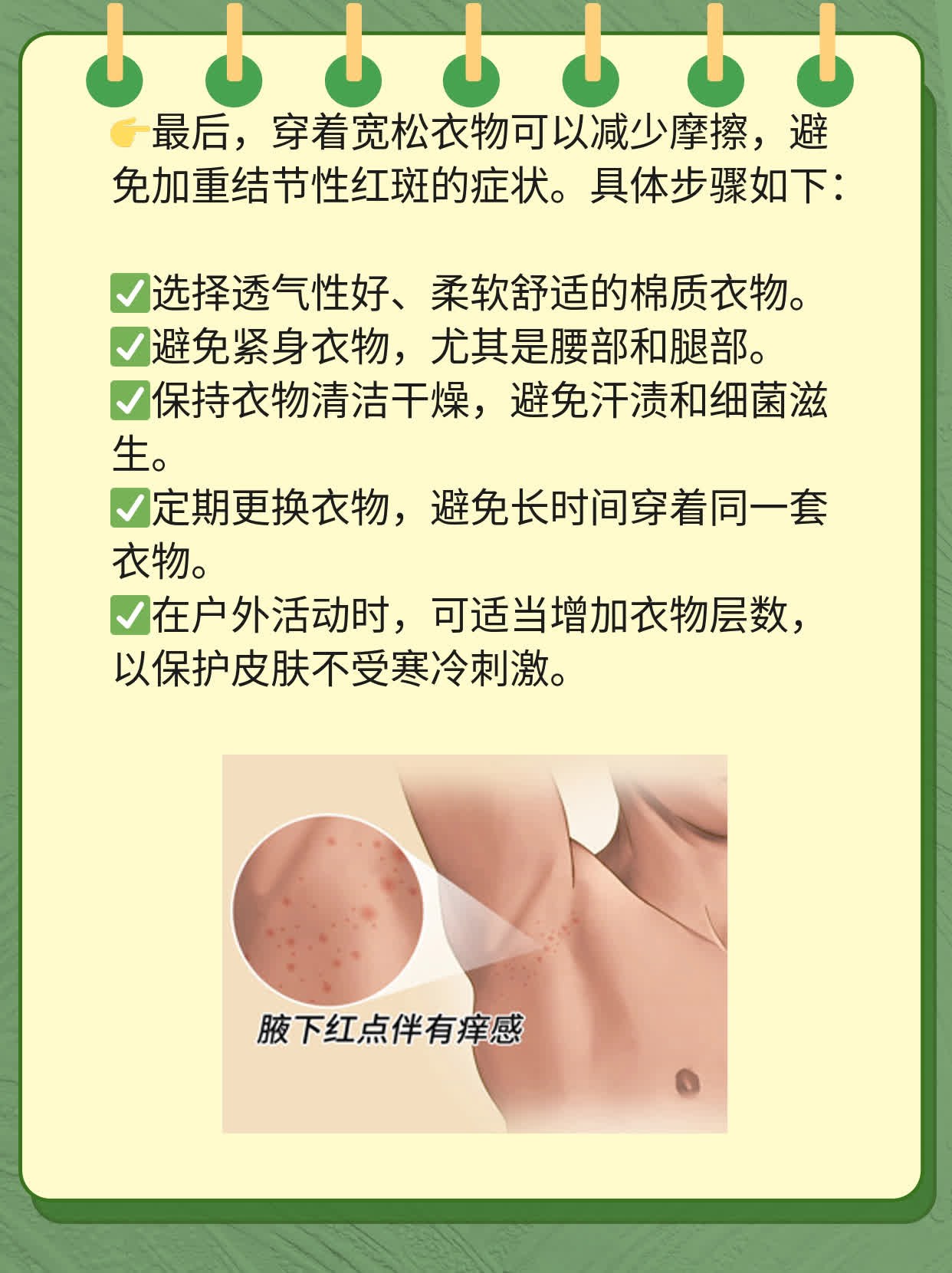「结节性红斑」临床表现全揭秘！