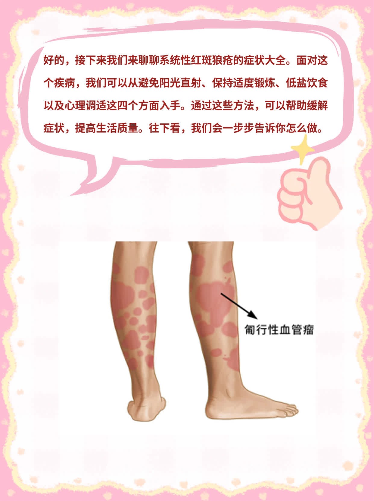 「经验分享」系统性红斑狼疮的症状大全