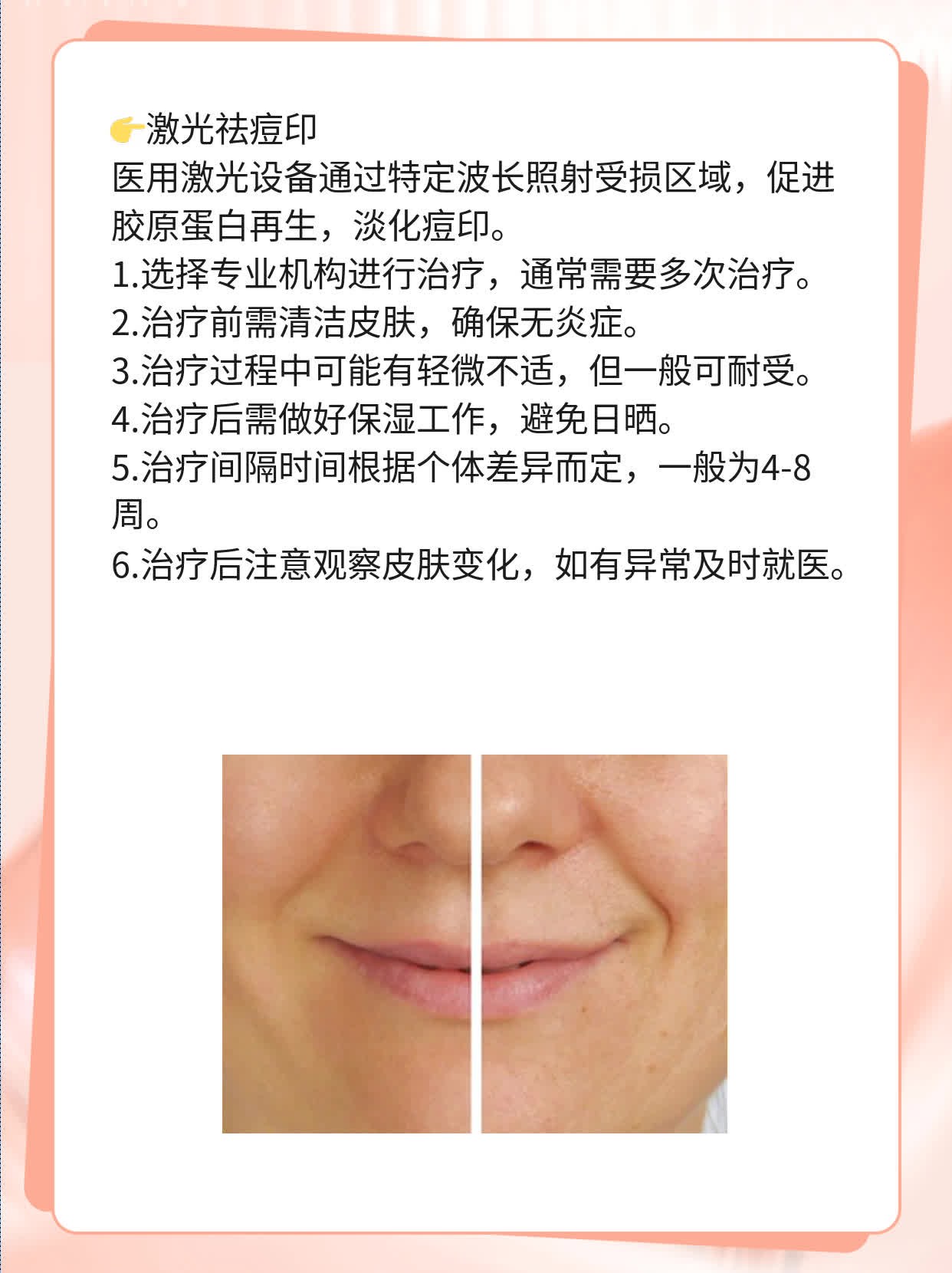「祛痘印」超快方法！用啥能搞定？