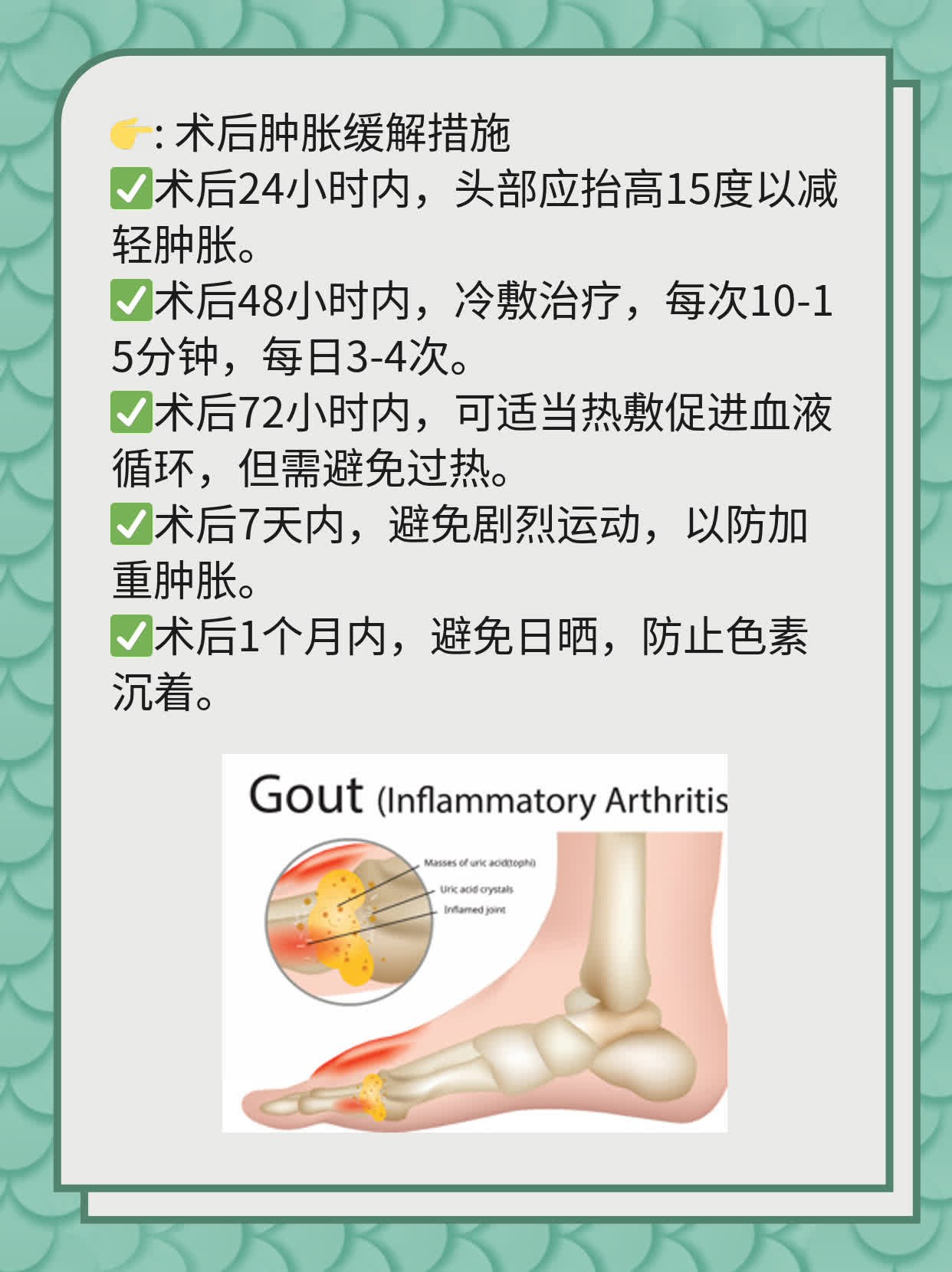 面部吸脂术后效果显现时间探秘