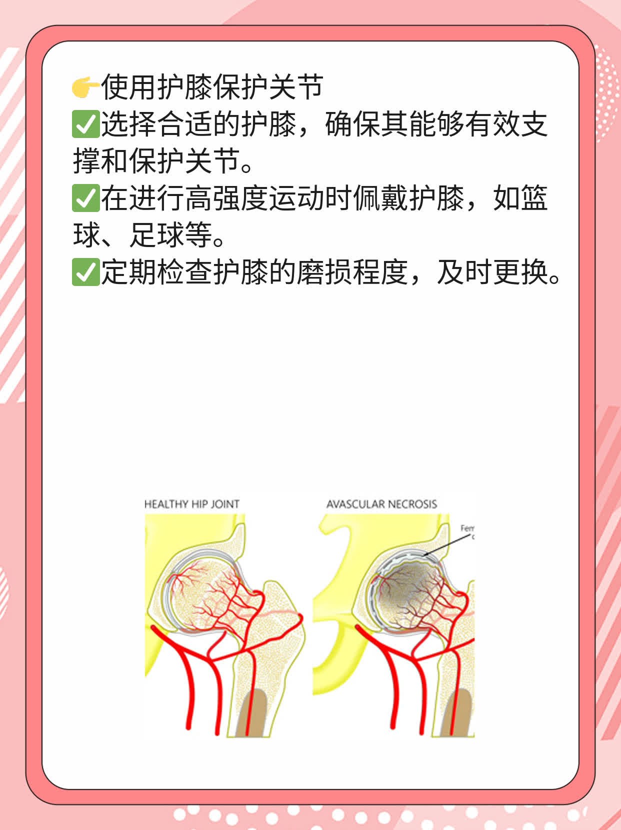 「中医巧治」半月板损伤及撕裂
