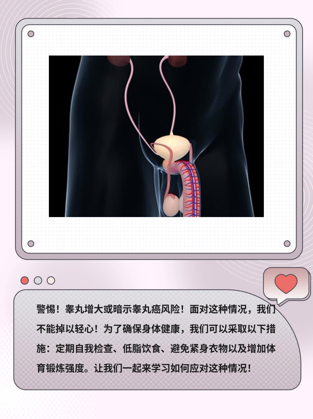警惕！睾丸增大或暗示睾丸癌风险！