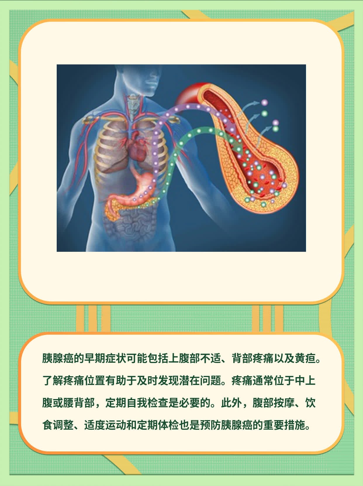 认识胰腺癌：早期症状与疼痛位置解析