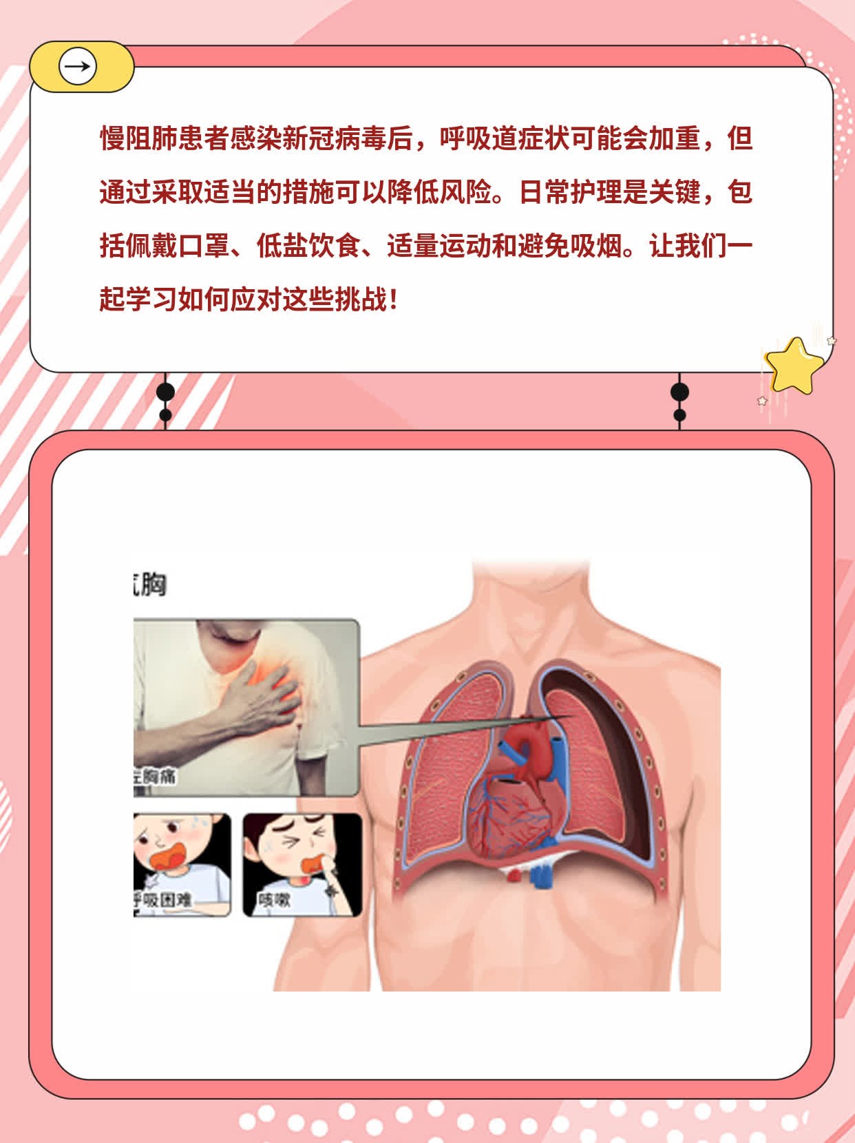 新冠感染对慢阻肺患者的威胁：一份实用指南