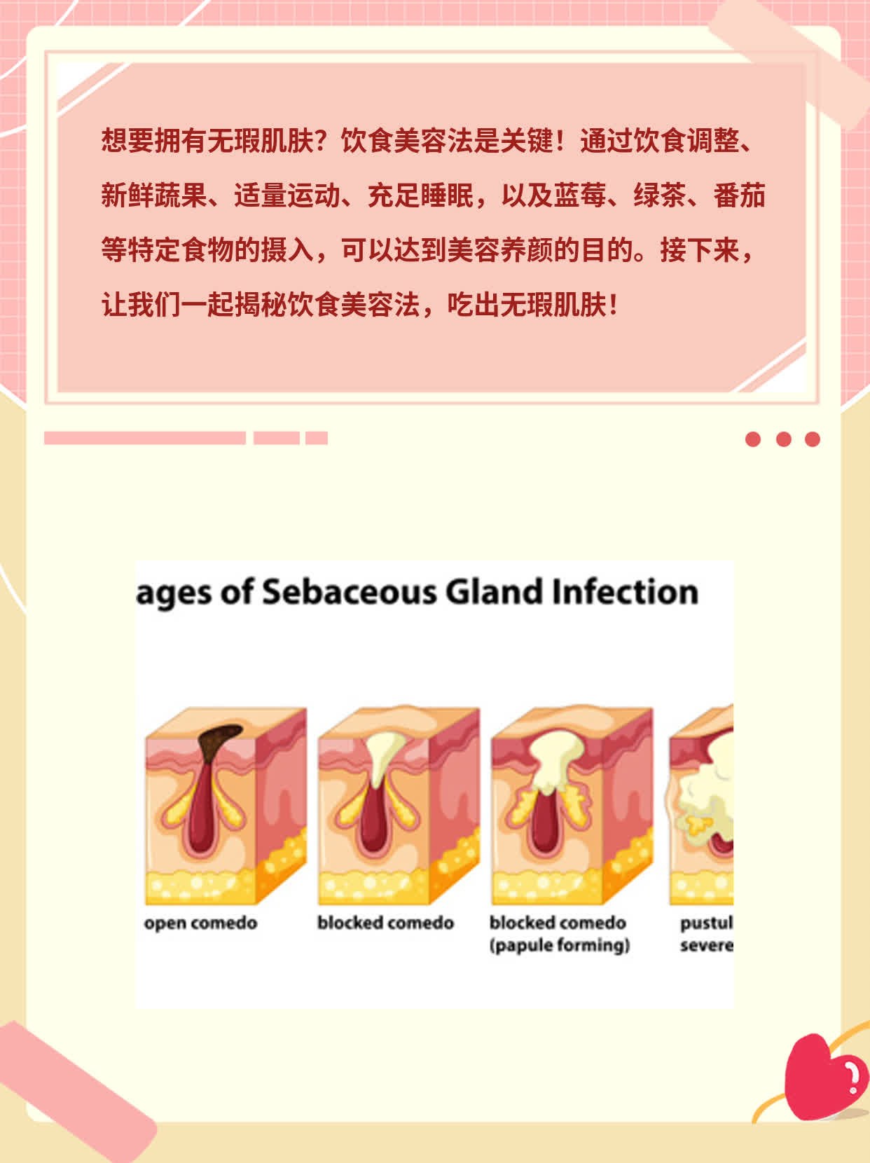 「揭秘」饮食美容法：吃出无瑕肌肤！