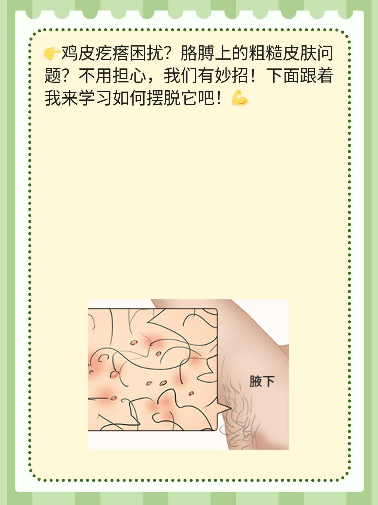 摆脱鸡皮疙瘩：胳膊上的粗糙皮肤问题解析