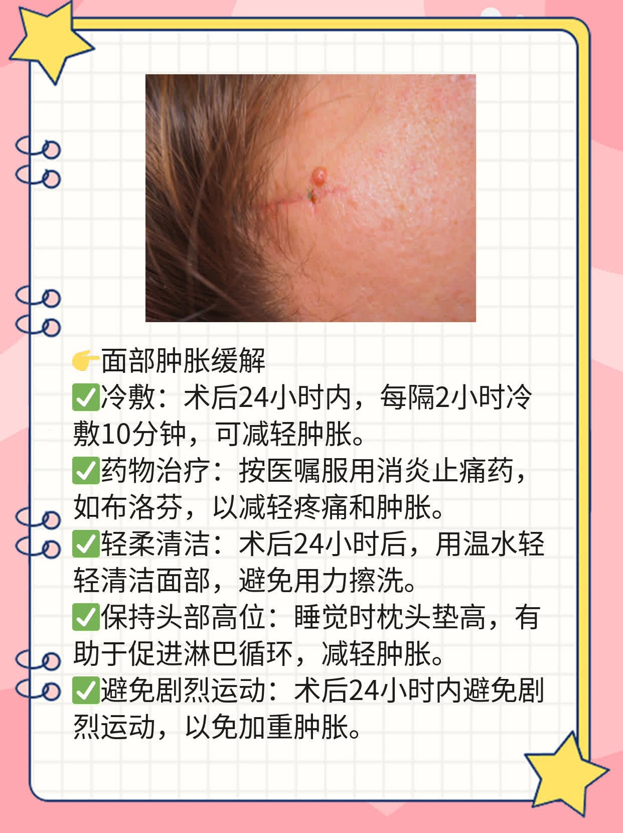 「面部吸脂后皮肤会松弛吗？」经验分享