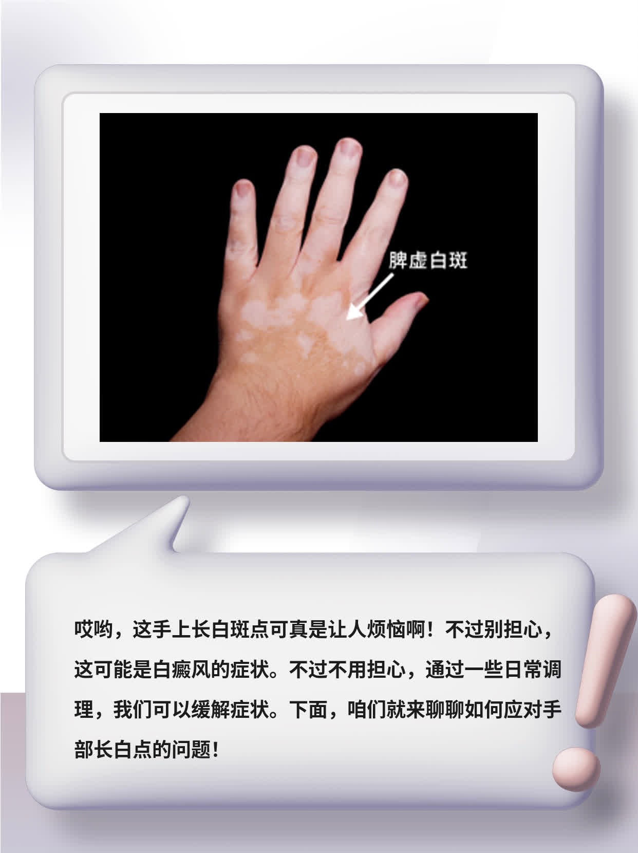 「手部长白点」：揭秘白斑病成因及处理方法！
