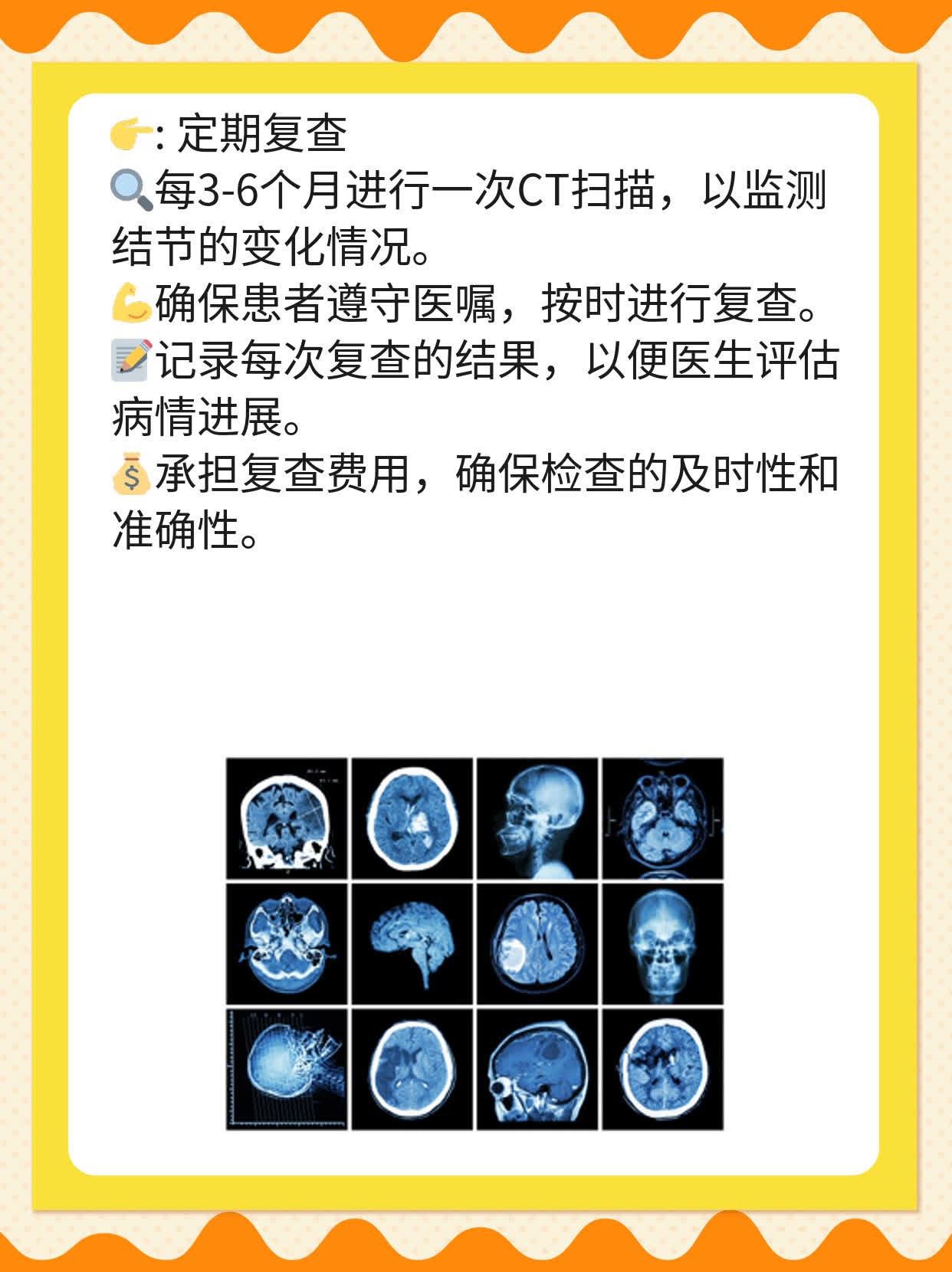 3毫米小结节在右下肺部？别慌！来了解真相！