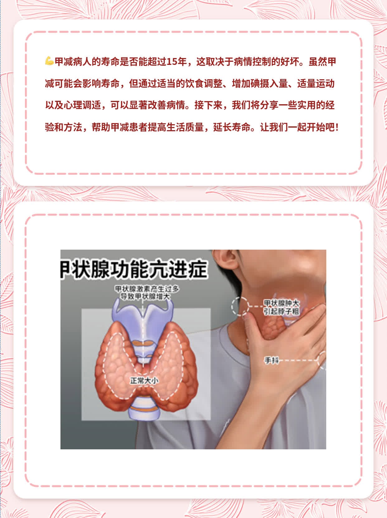 甲减病人的寿命能超过15年吗？经验分享！