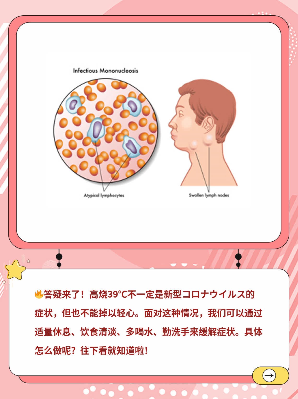 「有疑问？来答疑！」高烧39℃，这可能是新型コロナウイルス的症状吗？