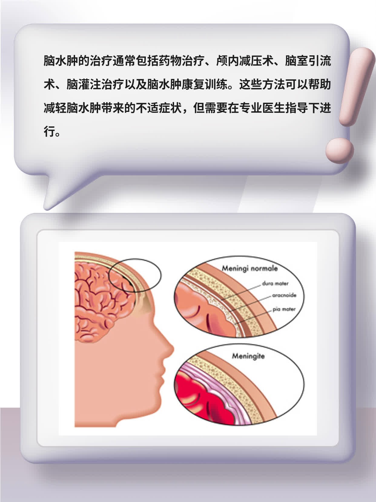 「脑水肿」治疗法大全！这5种方法让你轻松摆脱困扰！