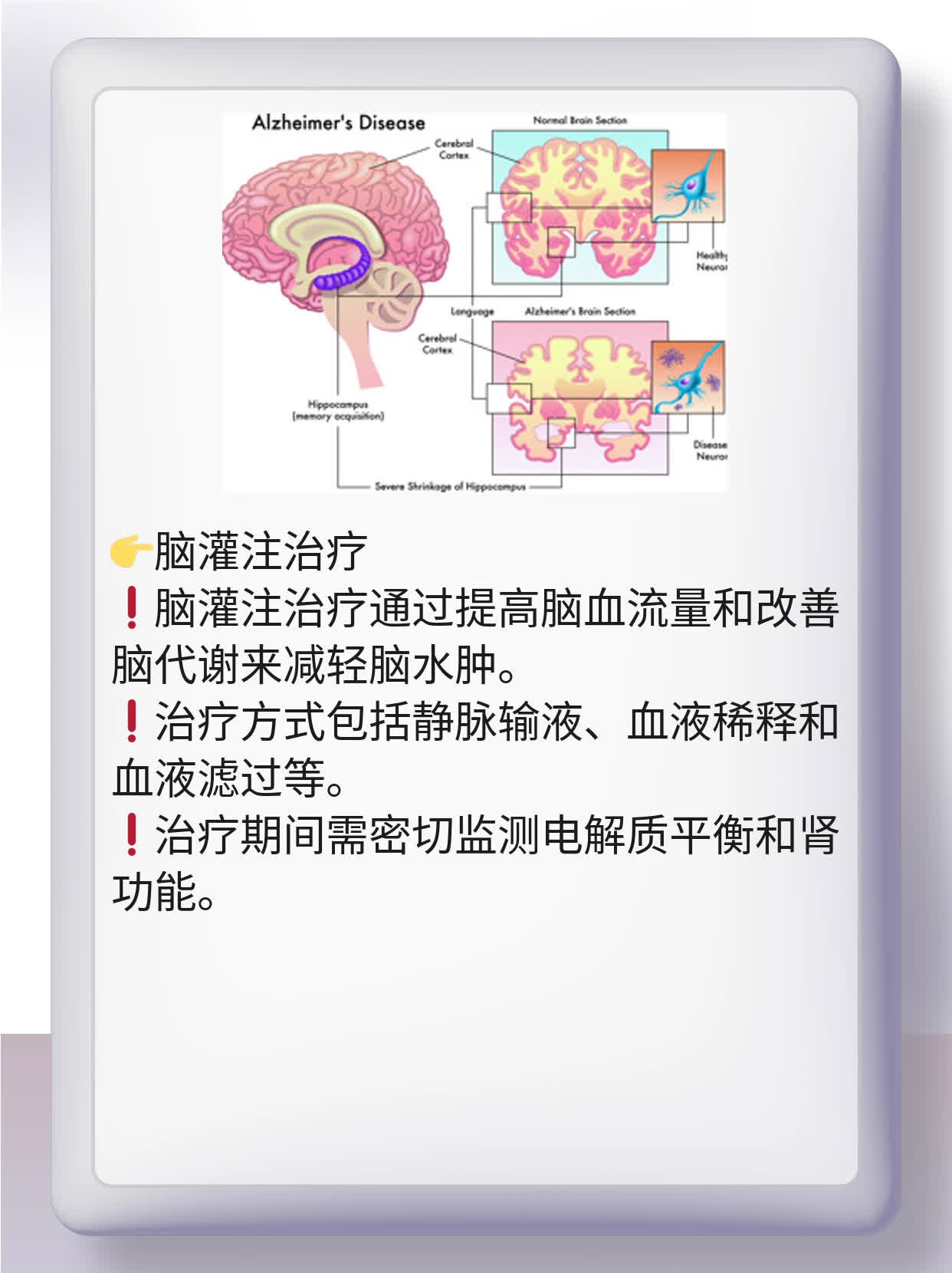 「脑水肿」治疗法大全！这5种方法让你轻松摆脱困扰！