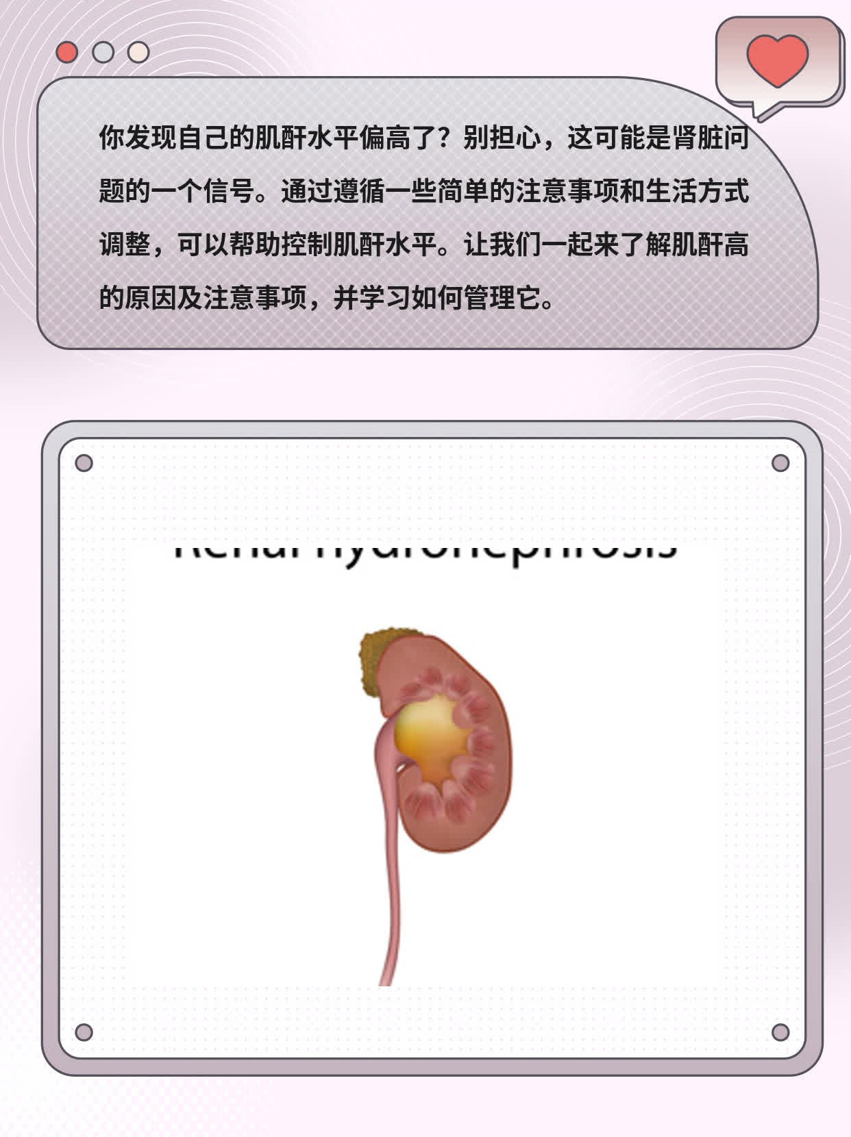 肌酐高的原因及注意事项