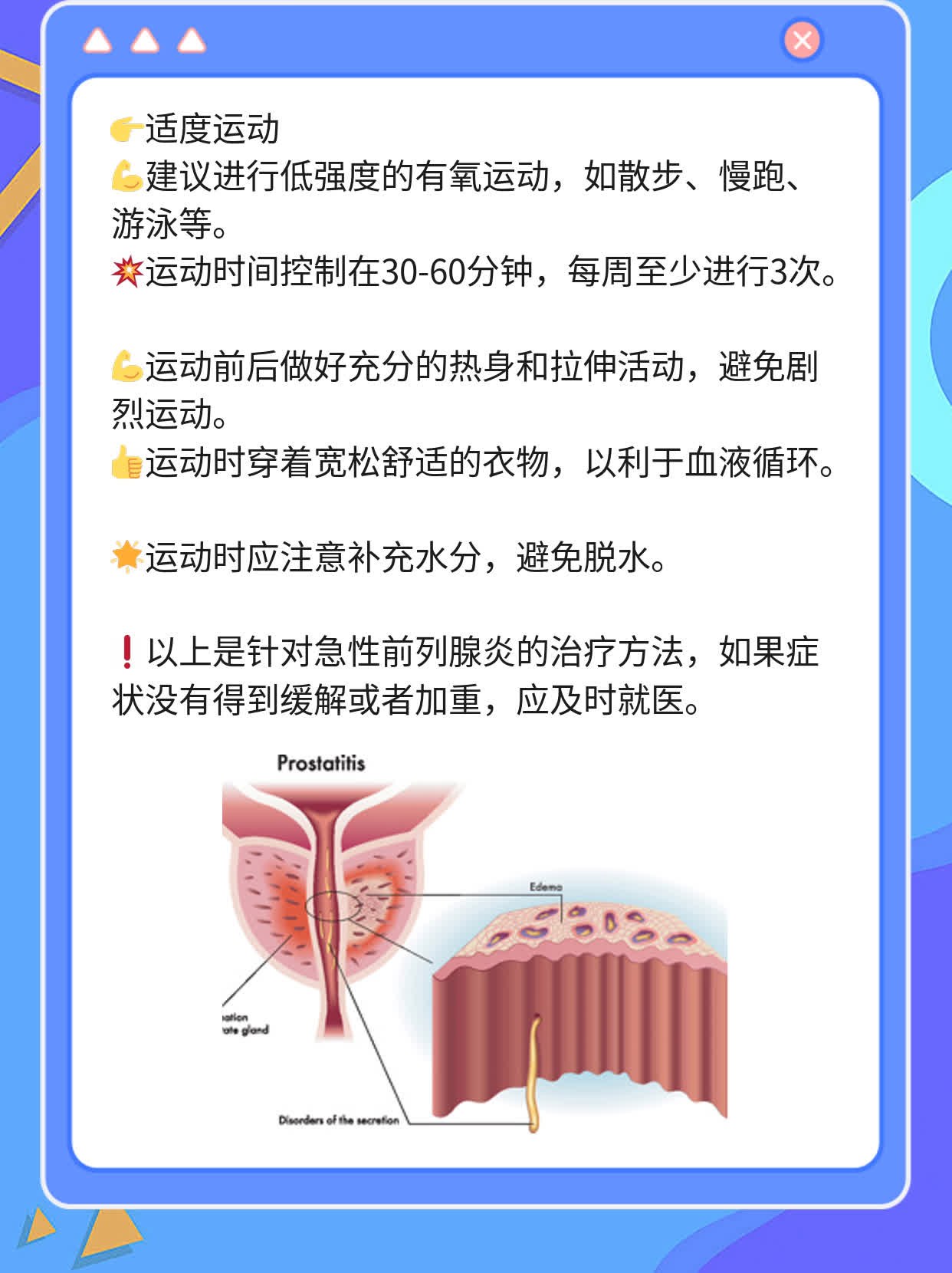 「经验分享」急性前列腺炎的治疗方法一览