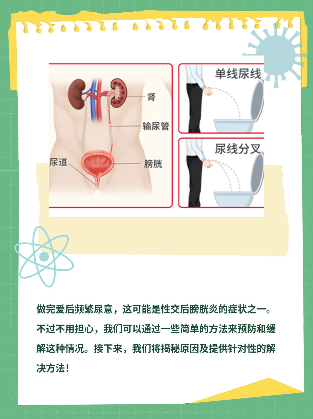 做完爱后频繁尿意，揭秘原因及解决方法！