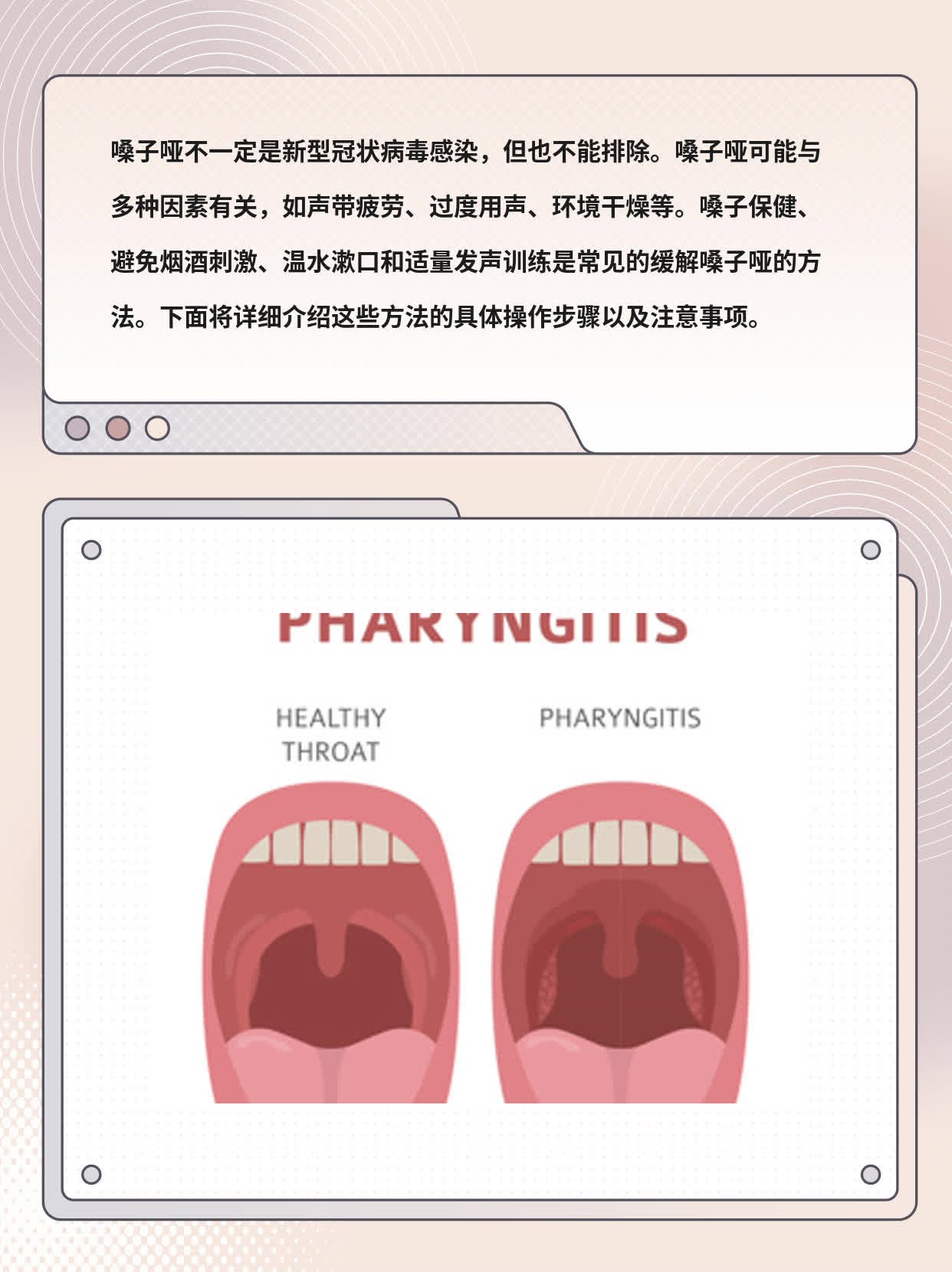 嗓子哑可能是新冠感染？经验分享