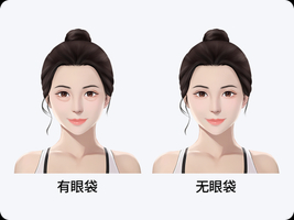 眼袋怎么才能消除