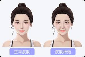 女人皮肤松弛怎么办，如何变紧致