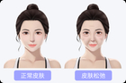 女人皮肤松弛怎么办，如何变紧致