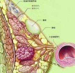 乳腺结节二级图片