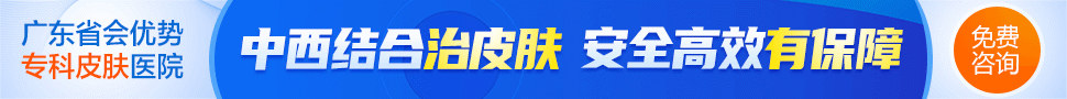 广州肤康皮肤病医院