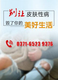 郑州治疗生殖器疱疹医院