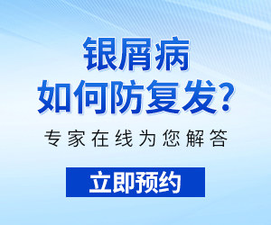 沈阳治疗牛皮癣医院