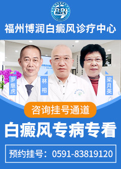 福州治疗白癜风医院