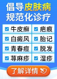 上海皮肤病专科医院