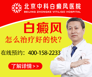 北京白癜风医院哪家好